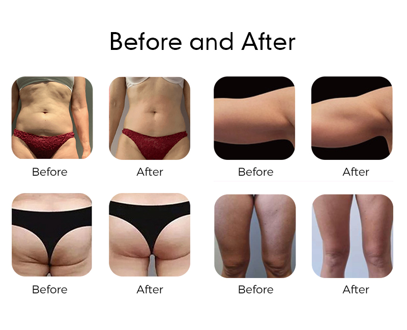 before after ems31_06