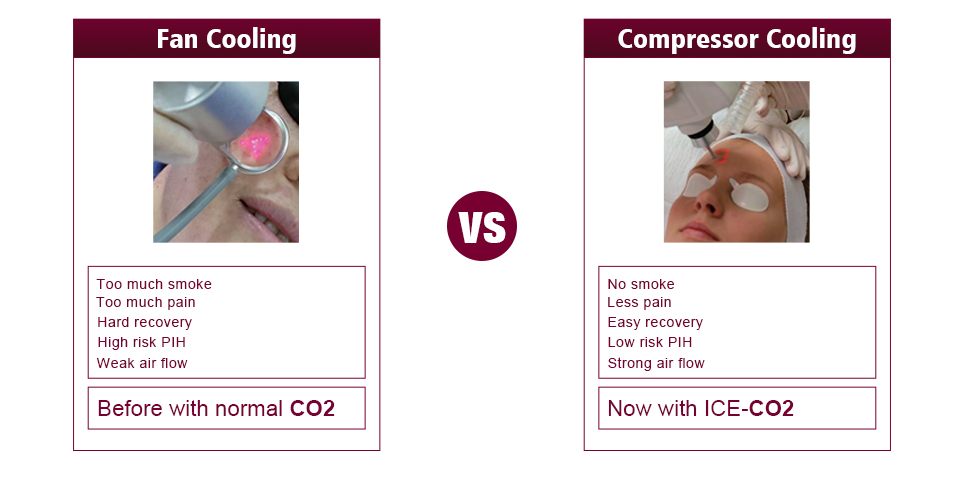 fractional laser resurfacing cost