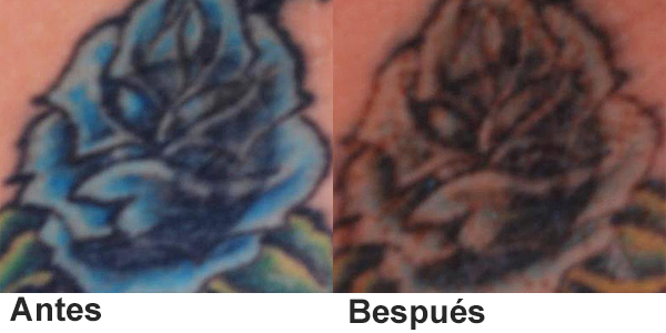 picosecond laser machine