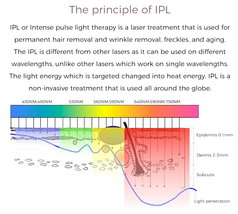 the principle of IPL