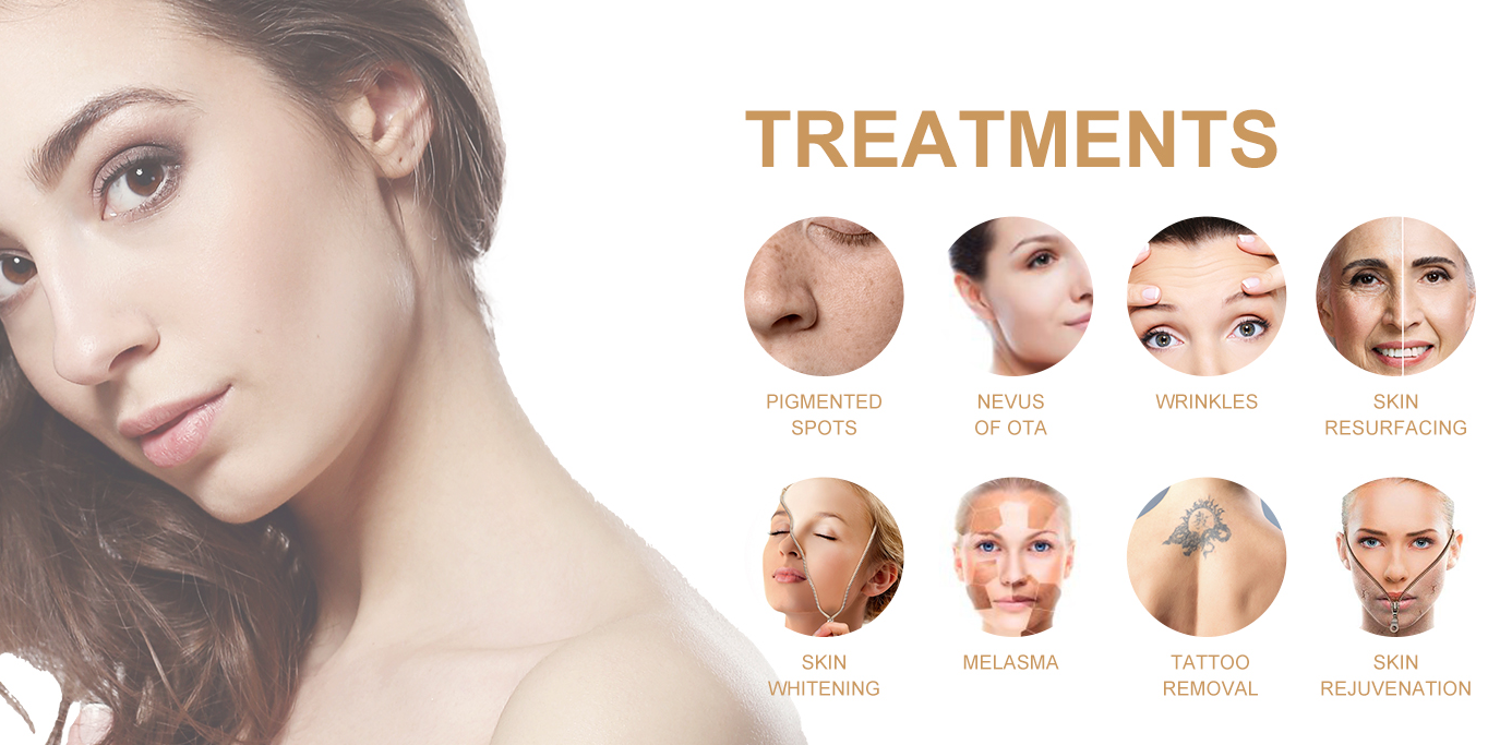 laser tattoo removal machine