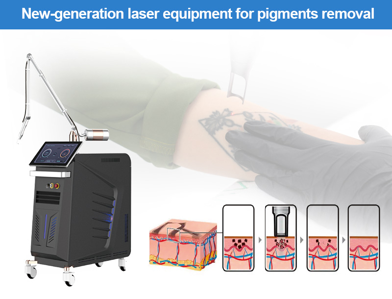 laser equipment