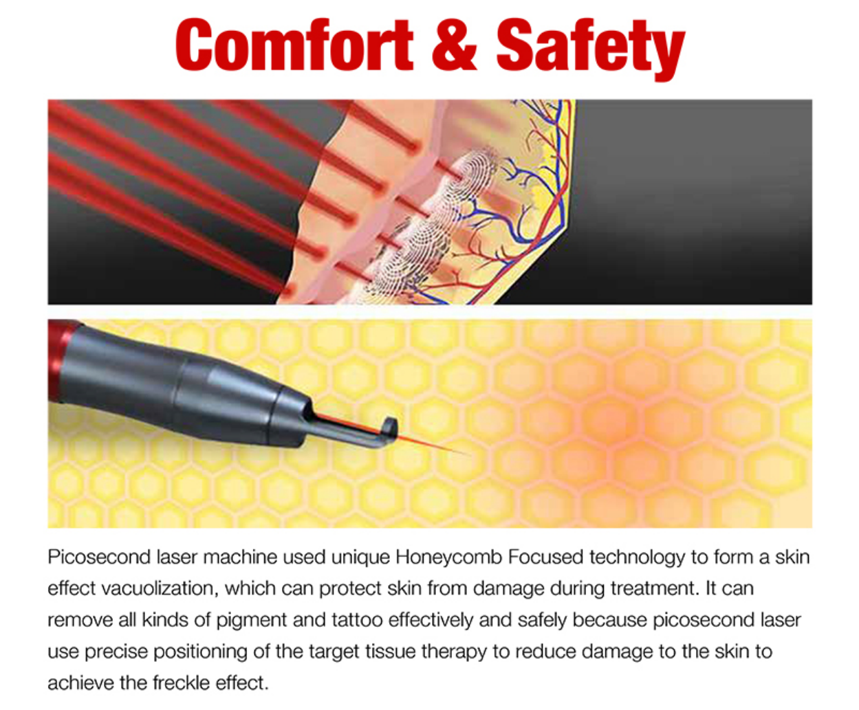 picosecond laser machine
