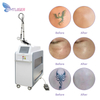 Picoway Laser Tattoo Removal Dark Spots Machine for Sale