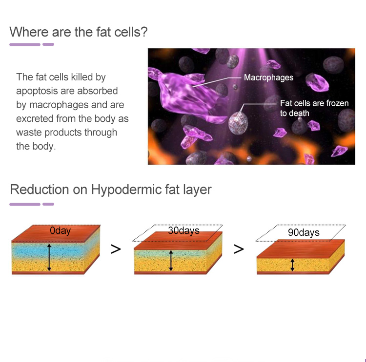 360 Degree Cooling Technology Cryolipolysis Slimming Machine Fat Freezing