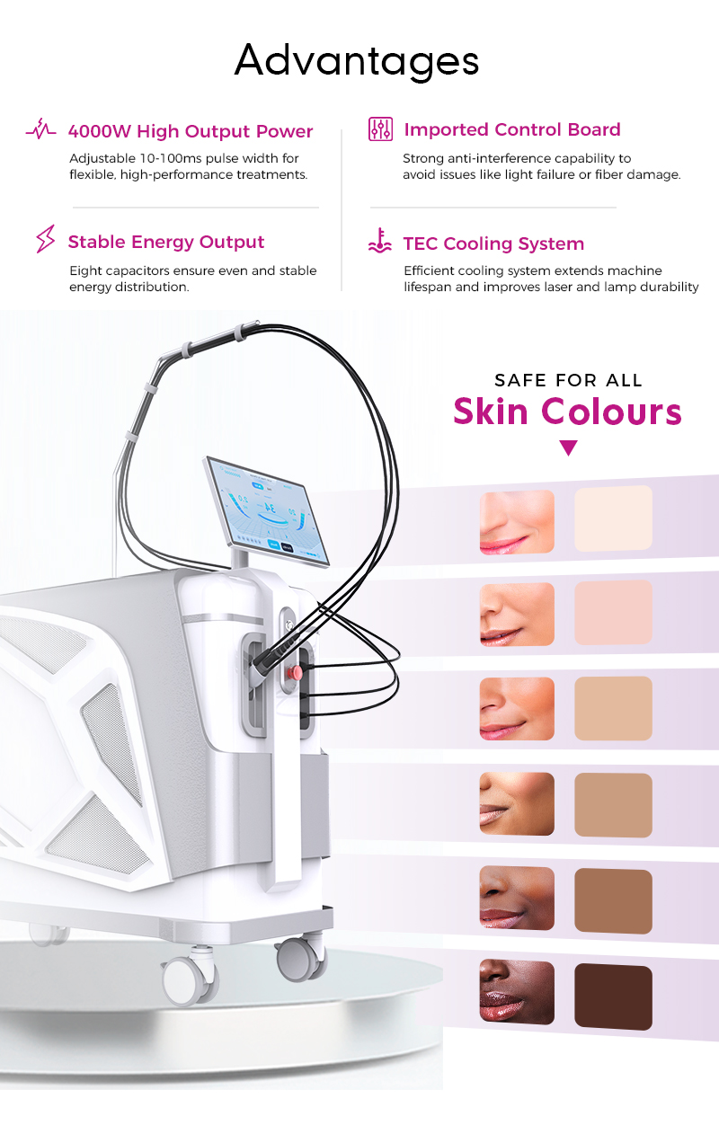 Advantages of Gentle YAG Laser Pro