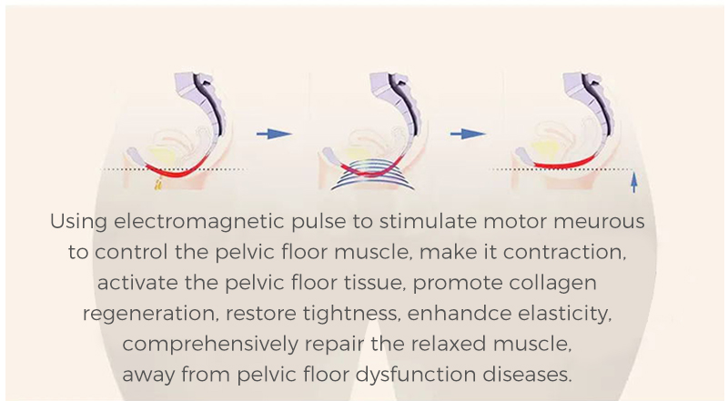 em body sculpting machine