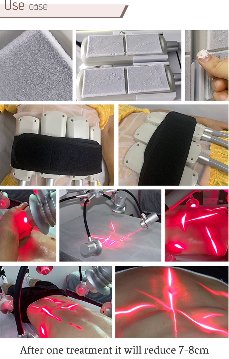 3 in 1 slimming and beautifying machine