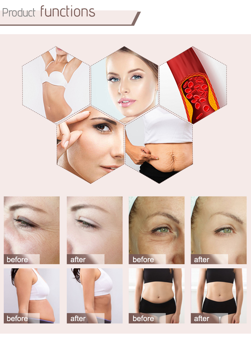 fat removal cavitation machine