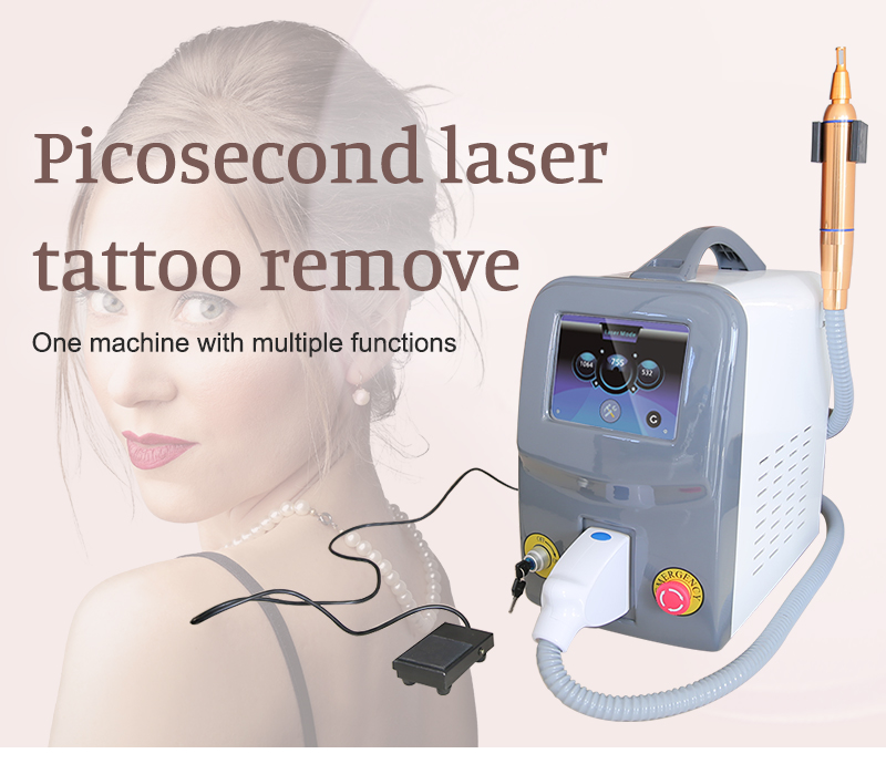 best way to remove tattoo