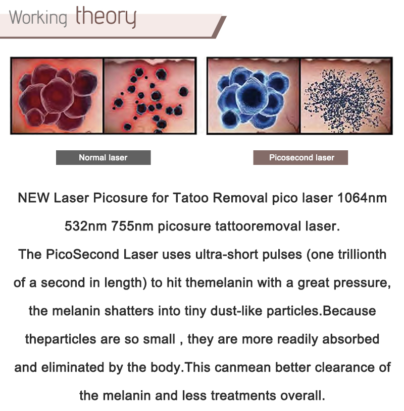 hypertrophic scar treatment