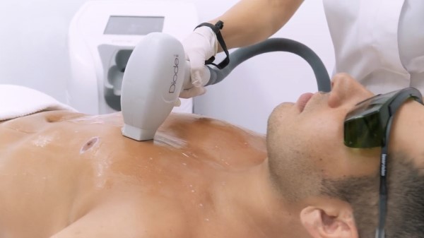 The Difference Between IPL and Diode Laser Hair Removal