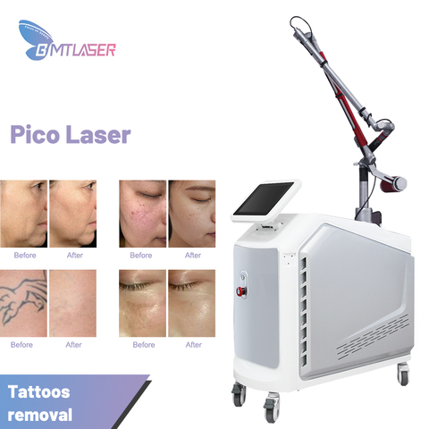 Commercial Laser Tattoo Removal Machine For Sale