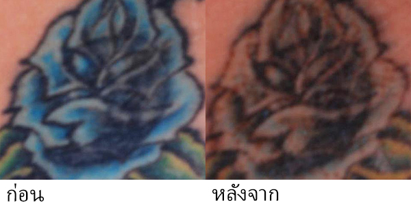 picosecond laser machine