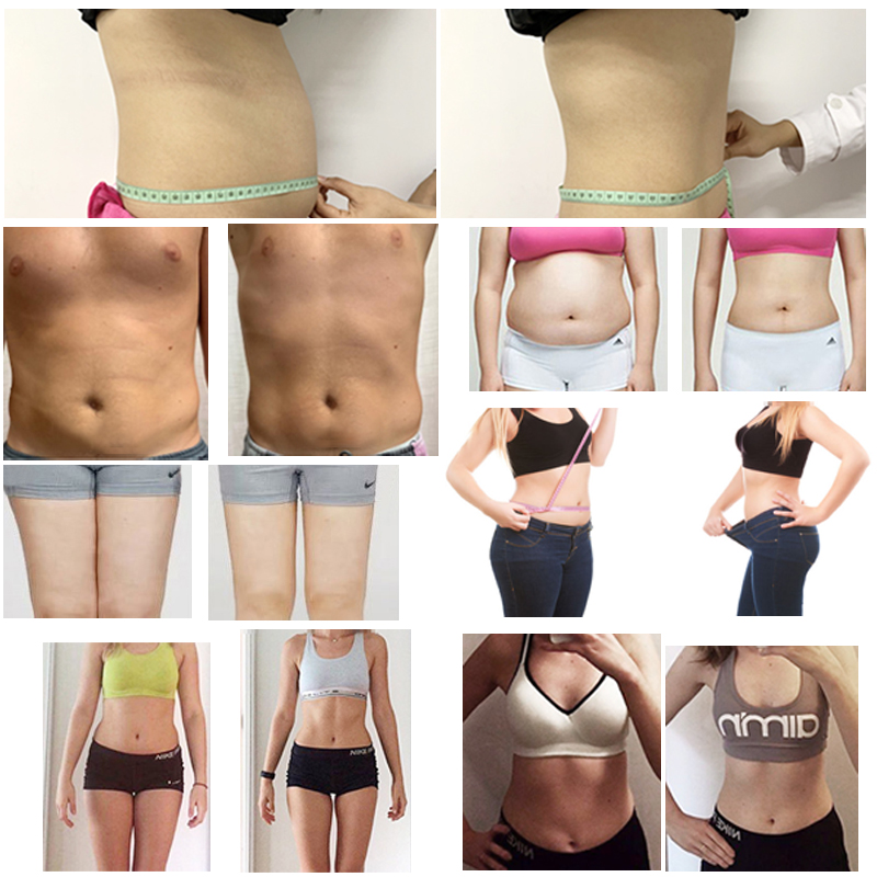 i lipo body slimming