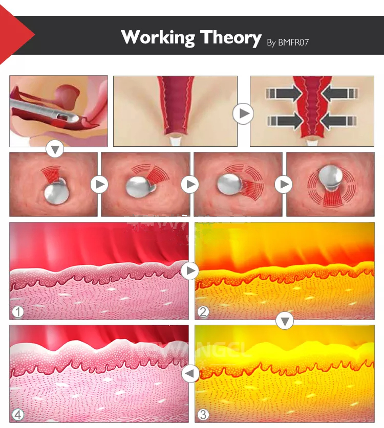 best vaginal tightening