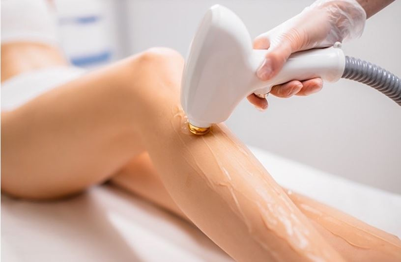 Advanced Laser Hair Removal Equipment: Home Use Or Professional?