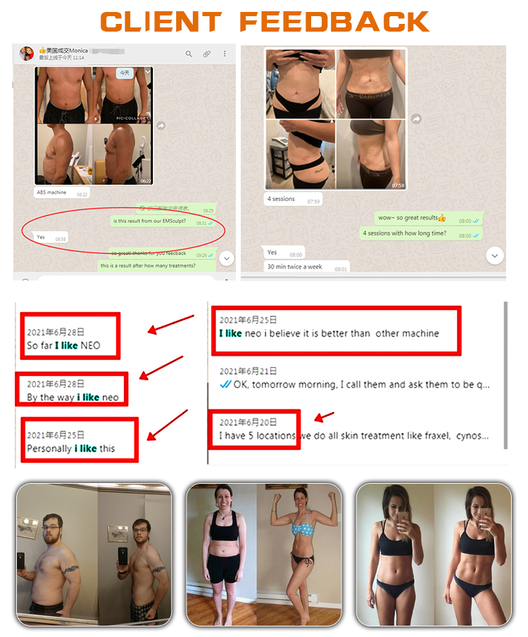 purchase emsculpt machine