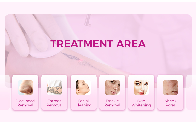 Q-switch Nd YAG Laser Machine for Tattoo Removal And Best Price From Suppliers