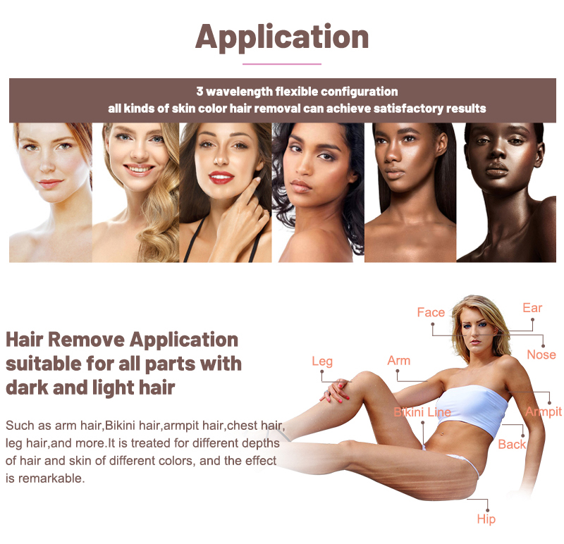 unwanted hair removal