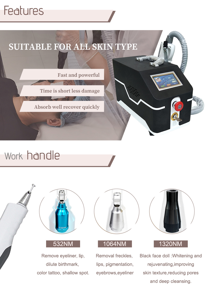 tattoo can be removed