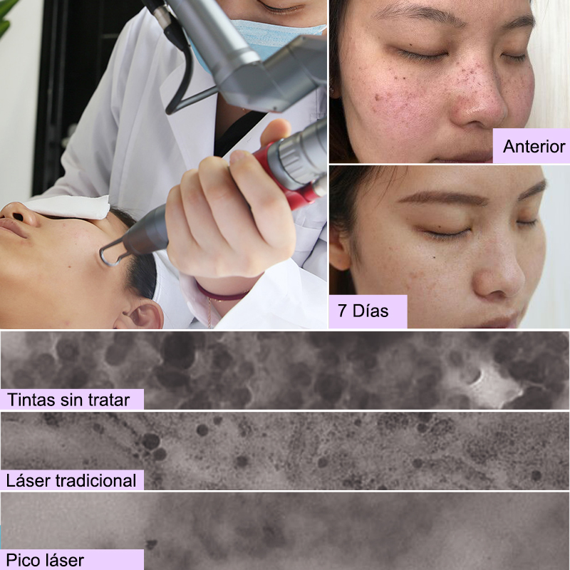 tratamientos para rejuvenecer el rostro