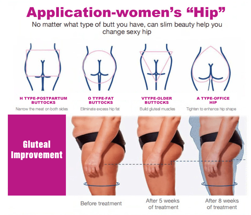 HIP Application