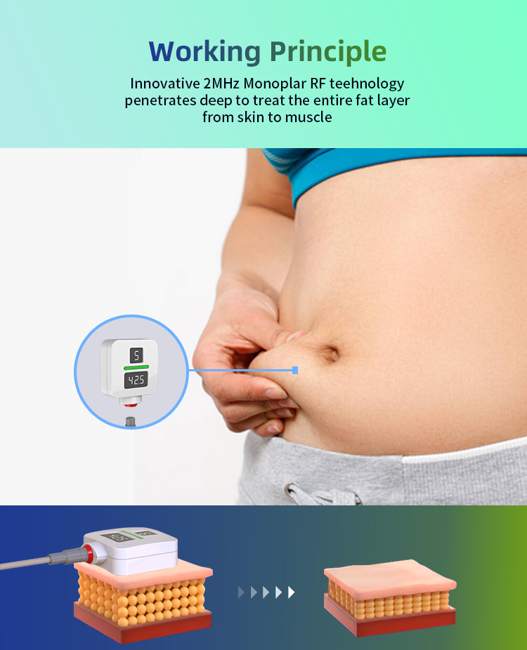 rf slimming