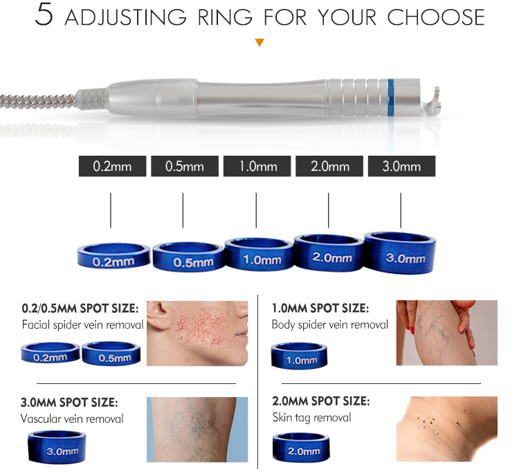 remove dark spots on face