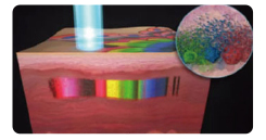 Unlocking the Secrets of Laser Beauty: Understanding Picosecond Laser Technology