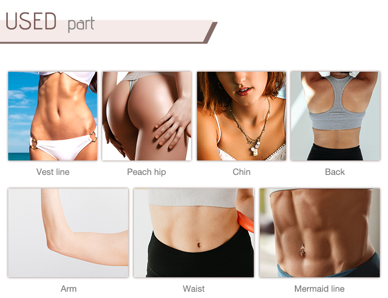 1060 diode laser slimming