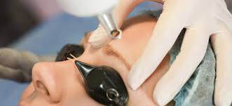 Picosecond Laser