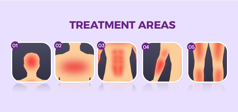 tattoo removal machine