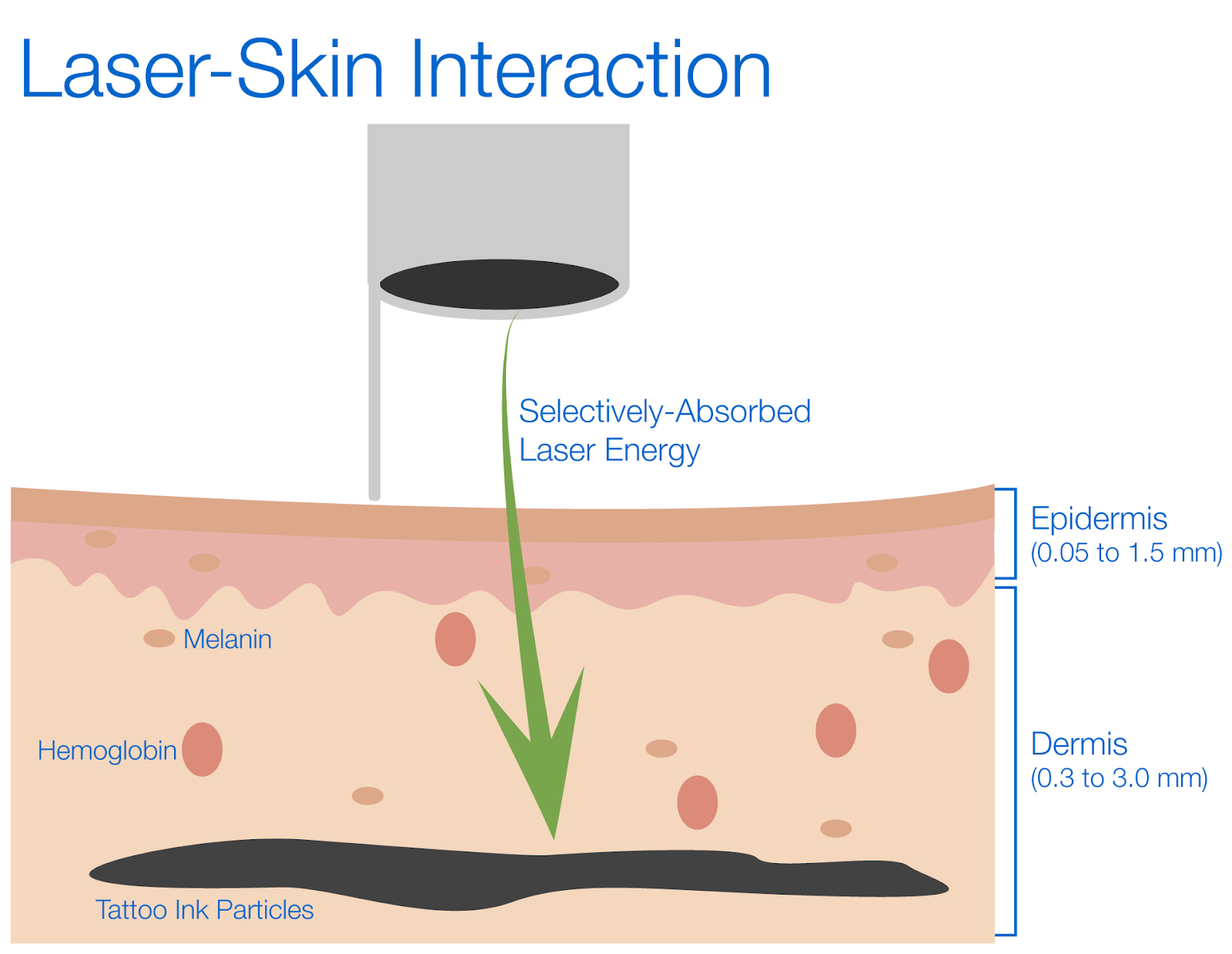 laser skin interaction