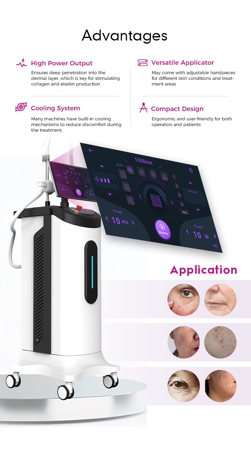 Erbium Laser Machines with 1550nm Glass Offer Effective Skin Resurfacing