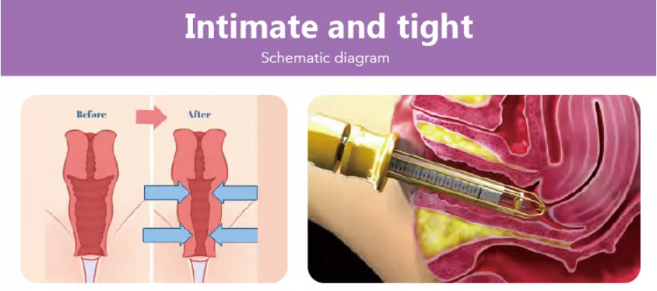 a84429a14b254bb99a3989bcb46e378e