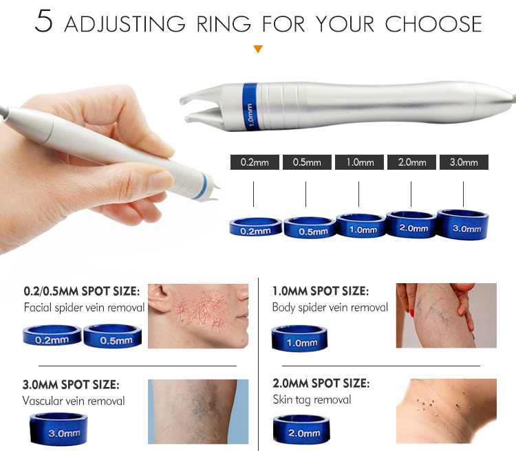 advanced physiotherapy