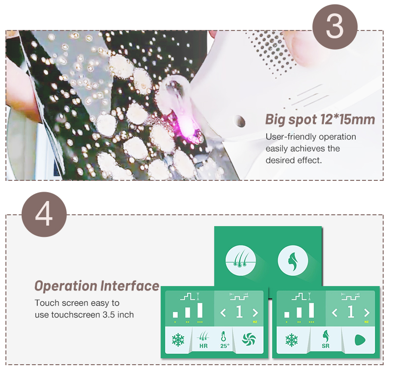 permanent hair removal machine