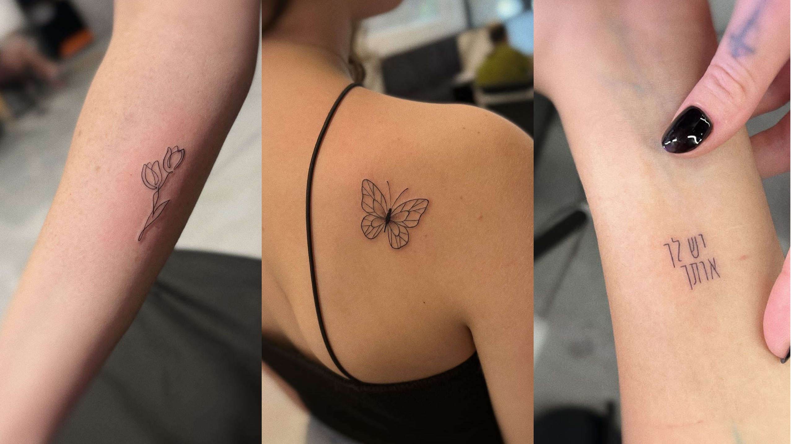 laser tattoo removal
