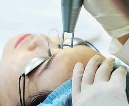 Cosmetic Laser Equipment