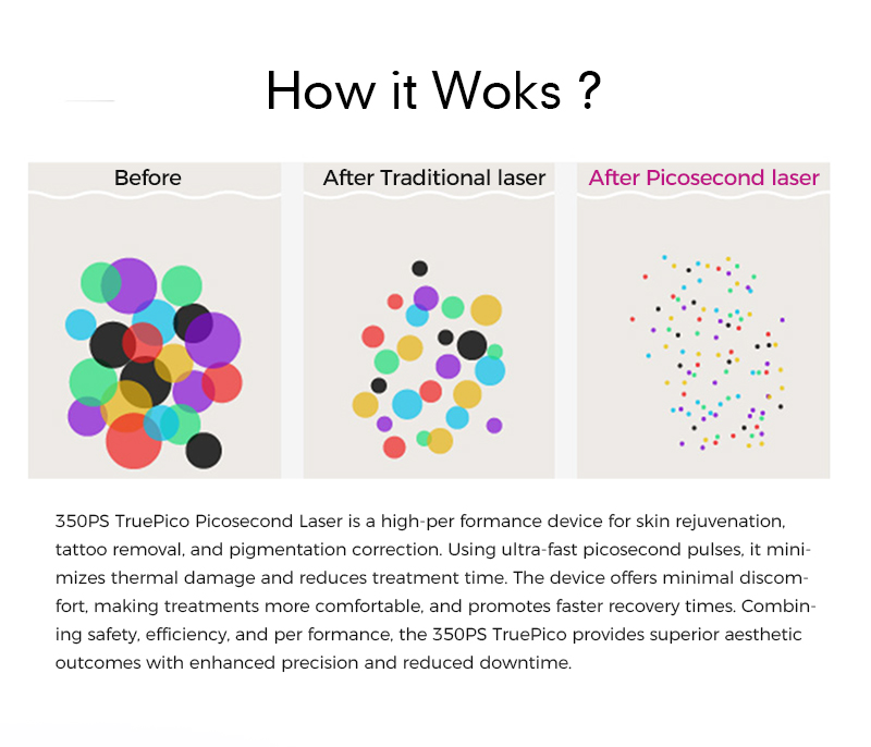 The 350ps True Picosecond Laser Provides Effective Tattoo Removal And Skin Treatments