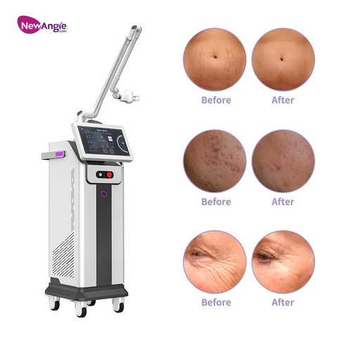 Best CO2 Fractional Laser Machine Skin Resurfacing Treatment Machine