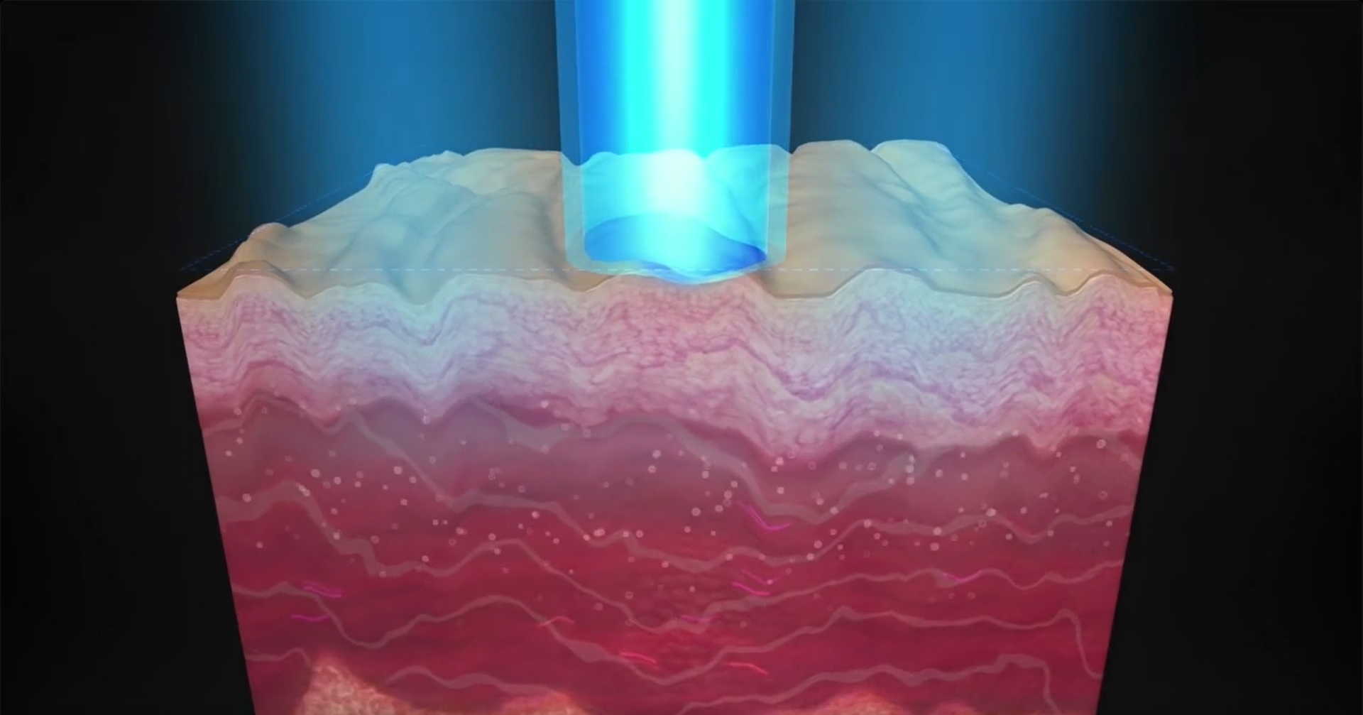 picosecond laser machine