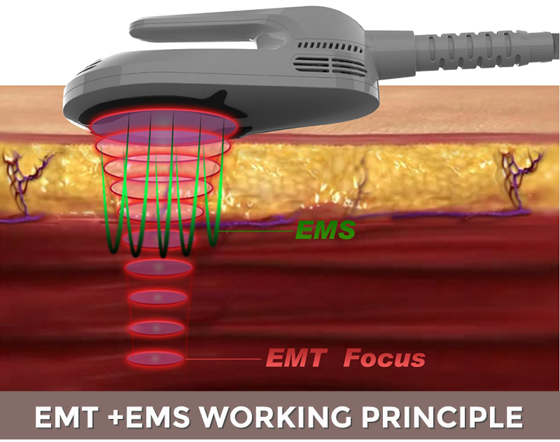 buy emsculpt neo machine