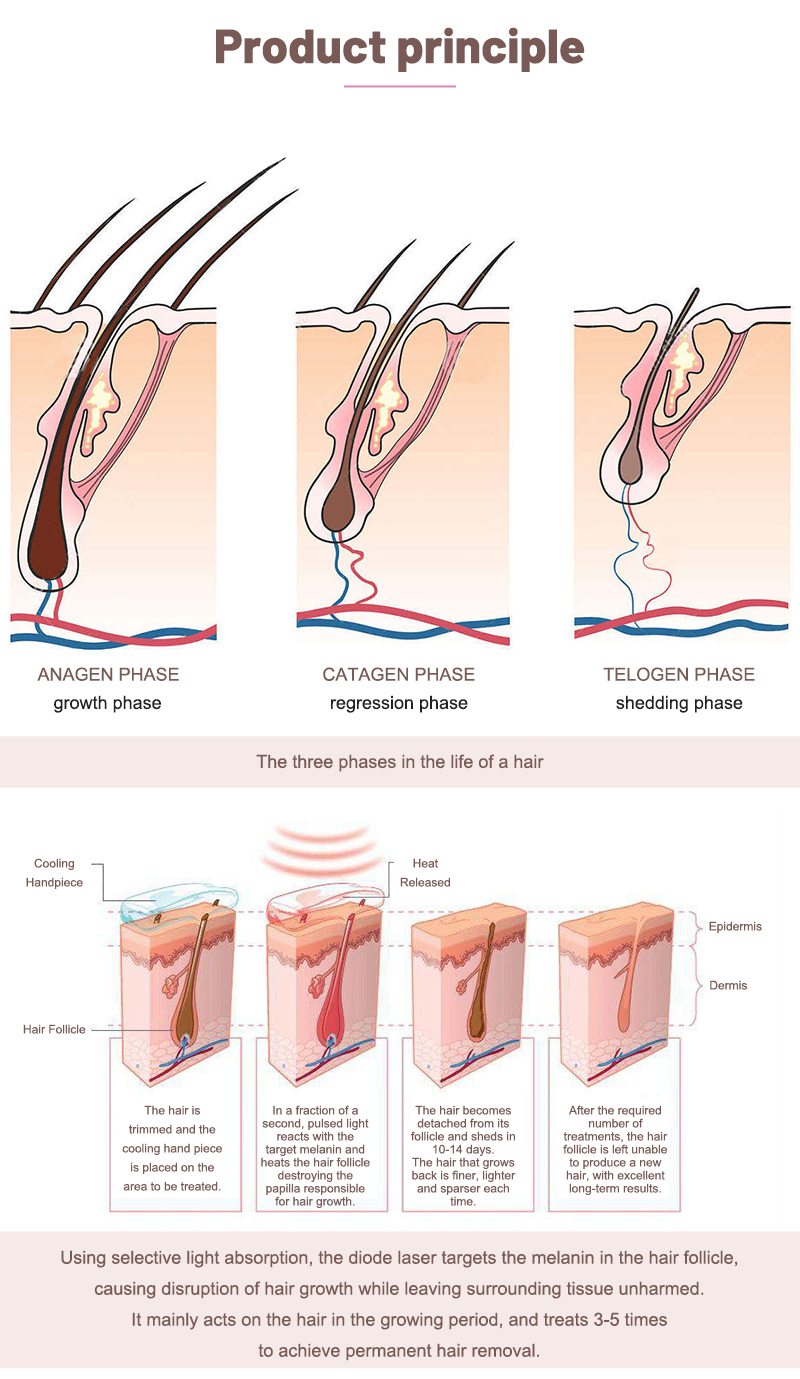 painless hair removal