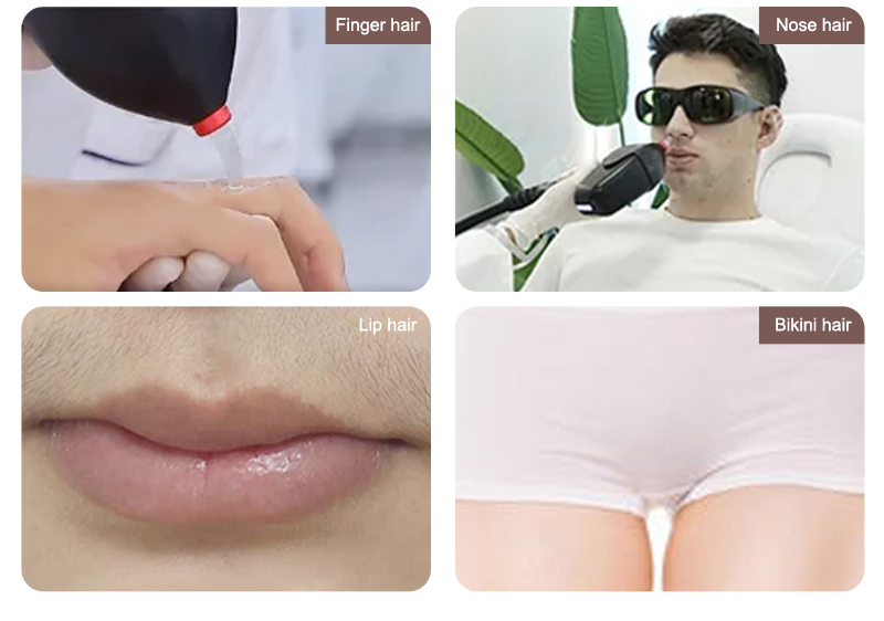 women with facial hair