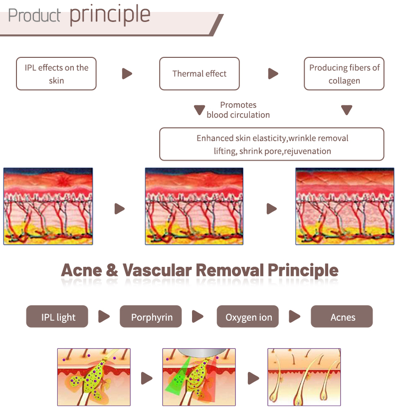 laser hair removal neck