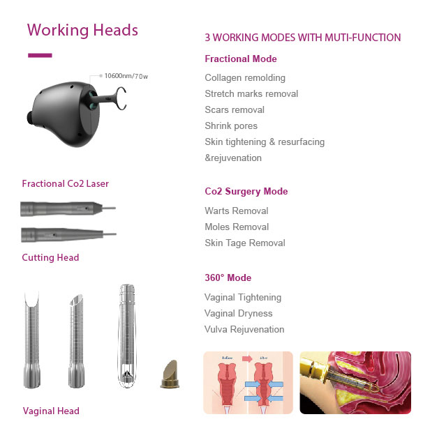 fractional co2 laser machine price