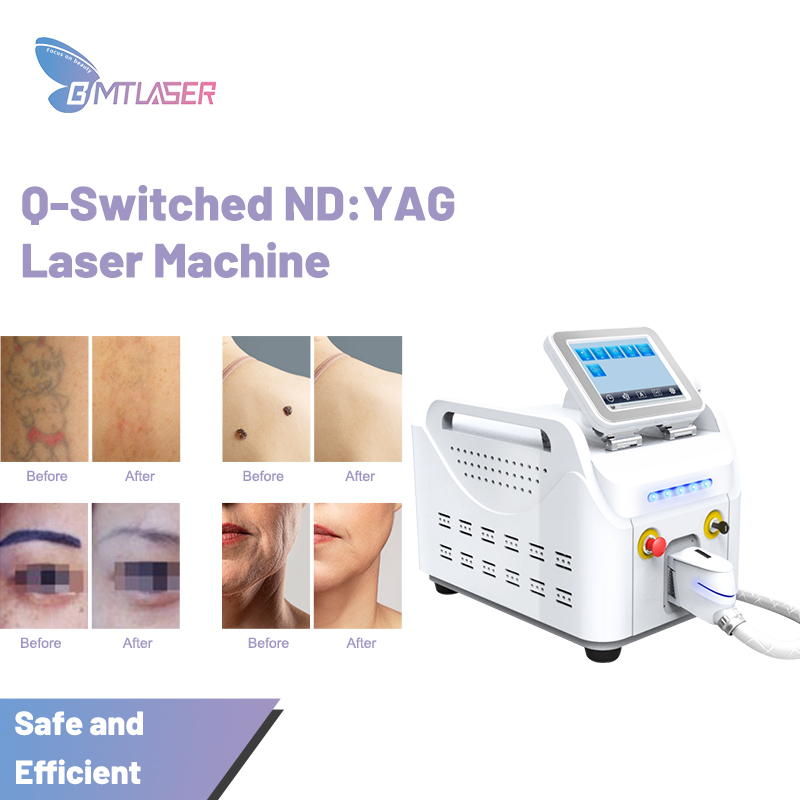 China Tattoo Removal Machine Manufacturers Tattoo Removal Machine china-tattoo-removal-machine-manufacturers-tattoo-removal-machine
