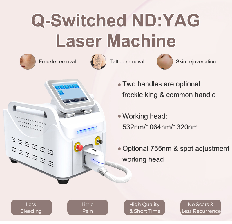 q switched nd yag laser tattoo removal